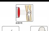 輻射成像科普：CT與MRI、超聲檢查有何區別?