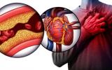 AI 在 3 秒內通過 MRI 掃描計算心臟周圍的脂肪堆積