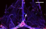Nature子刊：輕松清除小鼠胰腺癌的凝膠物